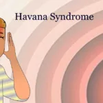 Unraveling Havana Syndrome: Causes, Symptoms, Investigations, and Insights